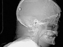 Фото новости